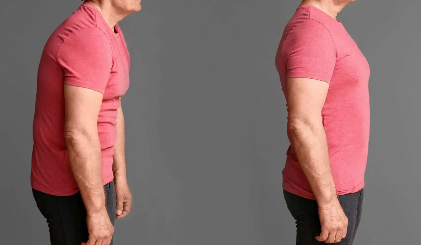 Reeducación postural